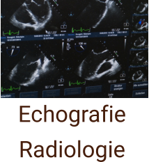 Echografie  Radiologie